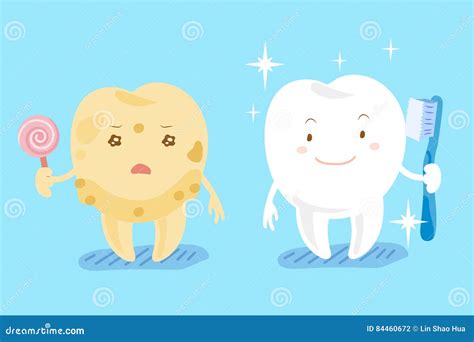 Dientes Sanos Y Caries Ilustración Del Vector Ilustración De Diente 84460672