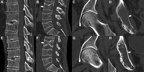 Emerging Technology In Musculoskeletal Mri And Ct Radiology