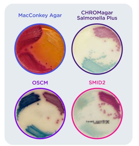 Evaluación del medio cromogénico CHROMagar Salmonella Plus para la