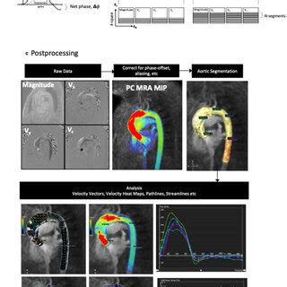 A Typical D Flow Data Acquisition Of The Thoracic Aorta A In The