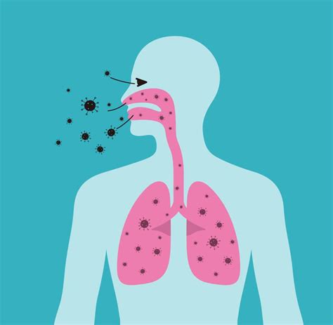 Coronavirus Weltweit Infizierte Tote L Nder Welt