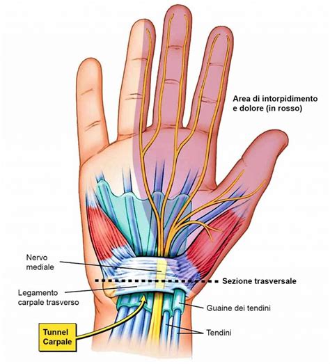 L osteopatia può aiutarti nel trattamento della sindrome del tunnel carpale