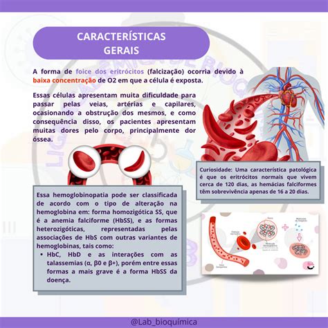 Caso Cl Nico De Anemia Falciforme Biologia Celular The Best Porn Website