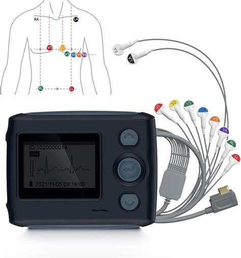 8 Channel 12 Lead EKG Machine With AI Generated Report 24 Hour Holter