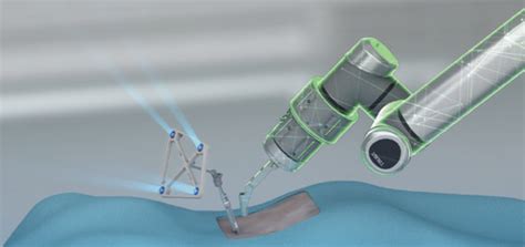 Tirobot One Orthopedic Robot Could Cover Spinal Surgery Joint