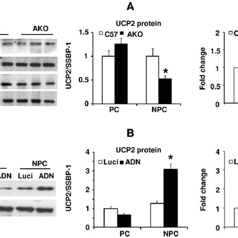 Adiponectin Promotes UCP2 Expression In Hepatic Endothelial Cells AKO