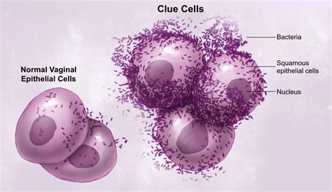 Presença De Clue Cells O Que Significa Braincp