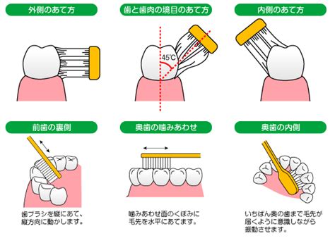 本当に正しい歯磨きの仕方を知っていますか？パート2 京阪電車守口市駅すぐの「三浦歯科医院」