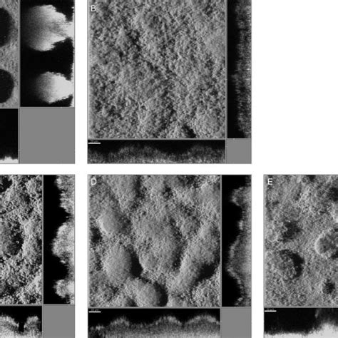 Clsm Pictures Of Day Old P Aeruginosa Biofilms A Untreated B