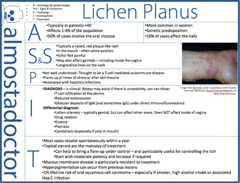 Lichen Planus Almostadoctor