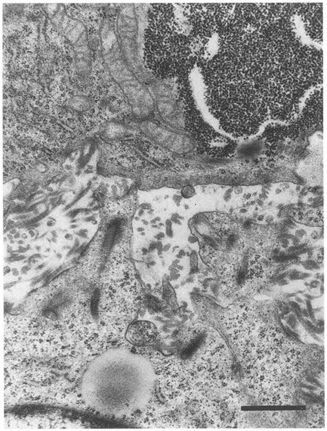 Transmission Electron Micrograph Of Cultured Cells A Stromal Cell Download Scientific Diagram