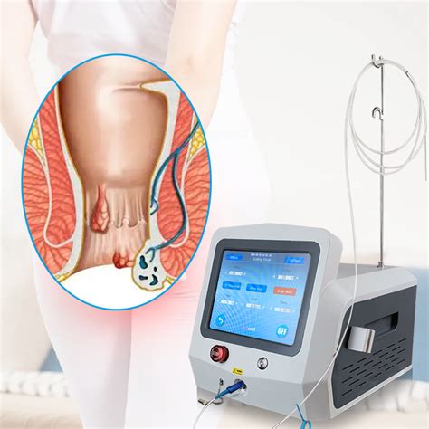 Hemorrhoids And Piles Removal Anal Fistula SMA905 Fiber Laser