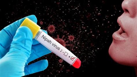 Mengenal Virus Nipah Begini Cara Penularan Dan Gejalanya Malay News