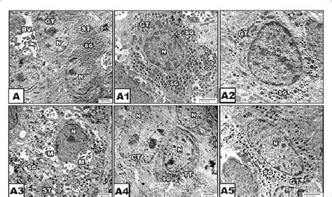 Transmission Electron Micrographs Of Anterior Lobe Of Control Pituitary