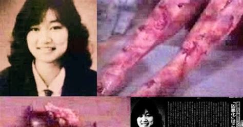 Junko Furuta Autopsy Report