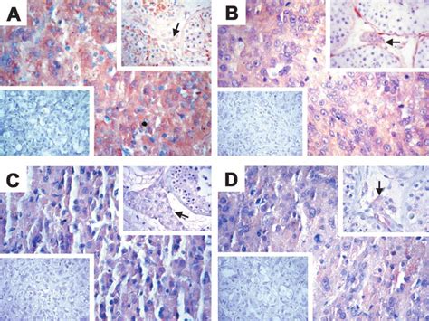 Immunohistochemical Localization Of Pdgf A Pdgf B Pdgfr And