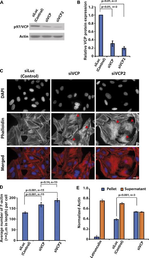 Figure From A Novel Function Of Aaa Atpase P Vcp In The Regulation