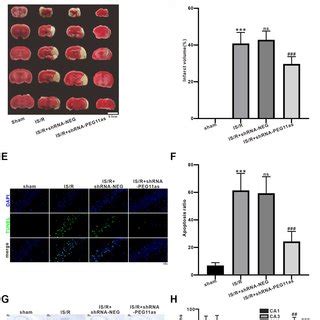 Peg As Silencing Alleviates The Acute Injury Of Cerebral Neurons