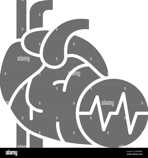 Obese Heart Surgery Stock Vector Images Alamy