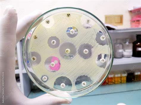 Antimicrobial Susceptibility Testing In Culture Plate Susceptibility