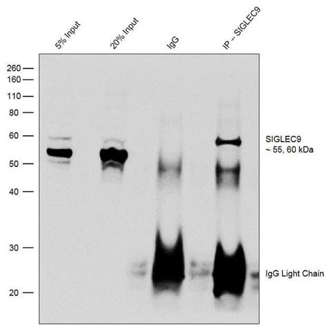 Antibodies for Immunoprecipitation (IP) | Thermo Fisher Scientific - US