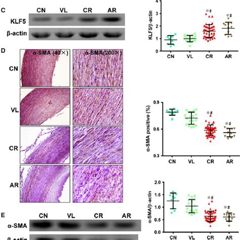 Aortic Vascular Smooth Muscle Cells VSMCs From Patients With