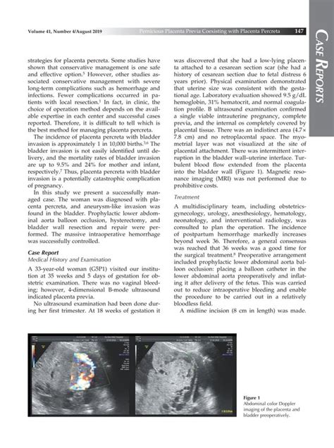 Aneurysm Like Invasion Into The Bladder Of Pernicious Placenta Previa With Placenta Percreta A