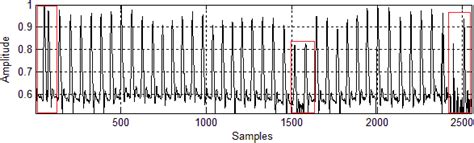 Envelope Of Maximum Frequencies Of A Doppler Blood Flow Signal