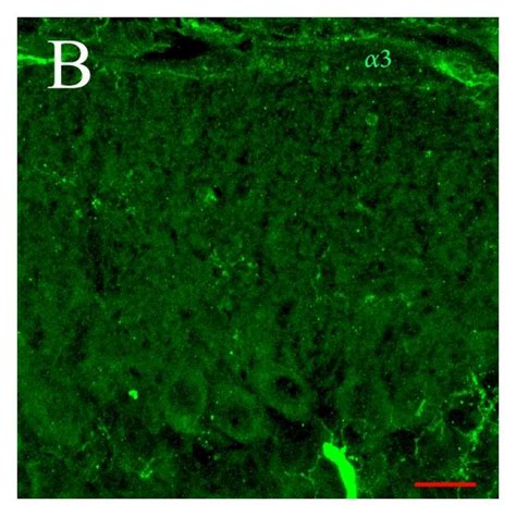 Confocal images of immunohistochemistry for the α3 isoform of Na K