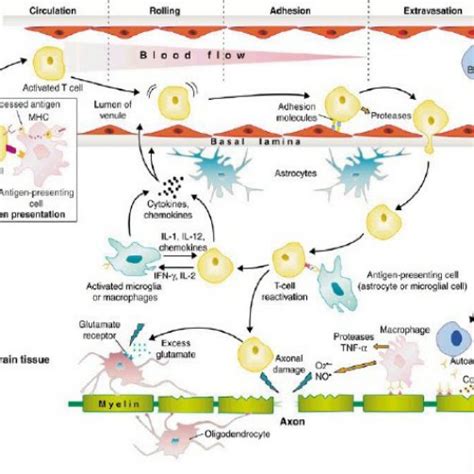 Different Eae Courses Acute Chronic Relapsing And Chronic Progressive