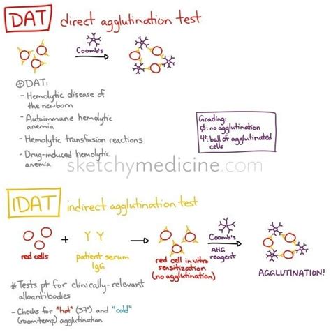 Direct Vs Indirect Coombs Test