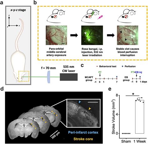 Photothrombotic Middle Cerebral Artery Occlusion In Mice A Novel Model