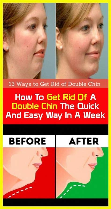 The Quick And Easy Way How To Get Rid Of A Double Chin Double Chin