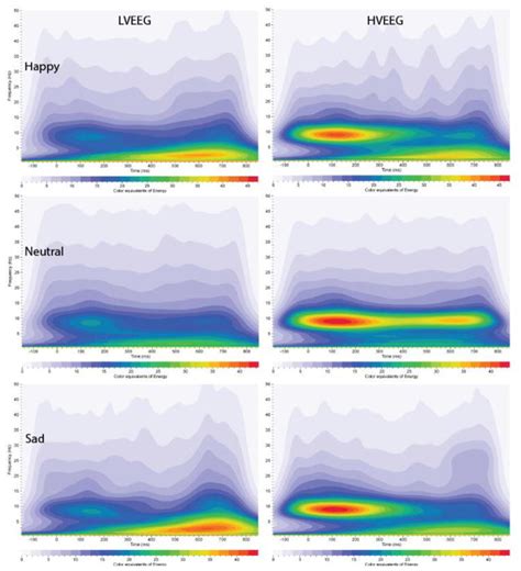 Low Voltage Alpha Eeg Phenotype Is Associated With Reduced Amplitudes