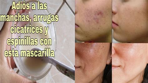 Con Esta Mascarilla Dile Adios A Las Manchas Arrugas Y Mas Como