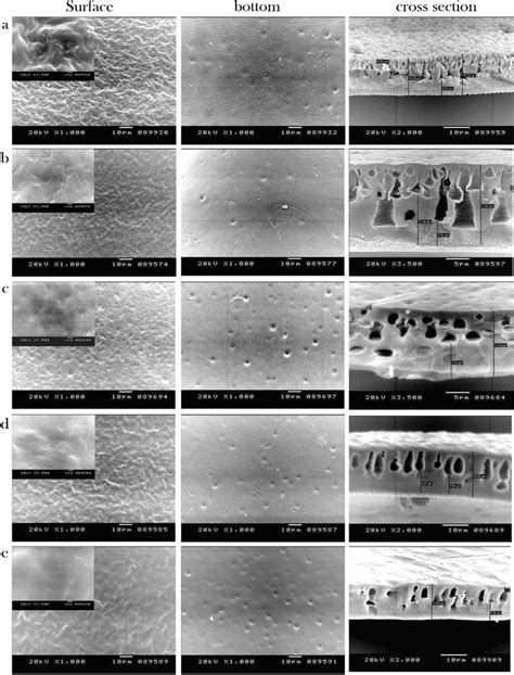 Sem Images Of Surface Bottom And Cross Section A Ca Ro Membrane