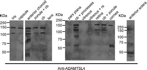 Western Blot Analysis Of Various Components Dissected From A Normal