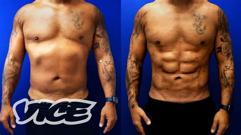 Surgery For Six Packs The Rise Of Male Plastic Surgery Youtube