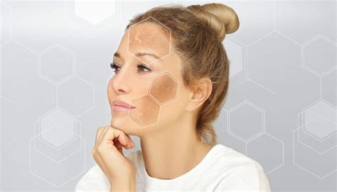 Skin Discoloration: Common Causes and Solutions · Conway Medical Center