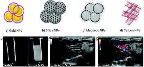 Recent Trends Of Contrast Agents In Ultrasound Imaging A Review Of The