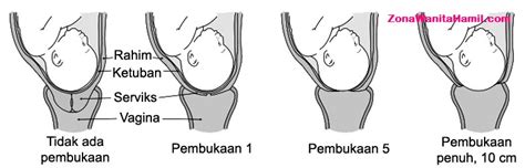 Tahap Tahap Dalam Proses Persalinan Normal Yang Wajib Diketahui