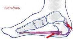 Plantar_Fascia_and_Achilles_Tendon_Drawing | Plantar Fasciit… | Flickr