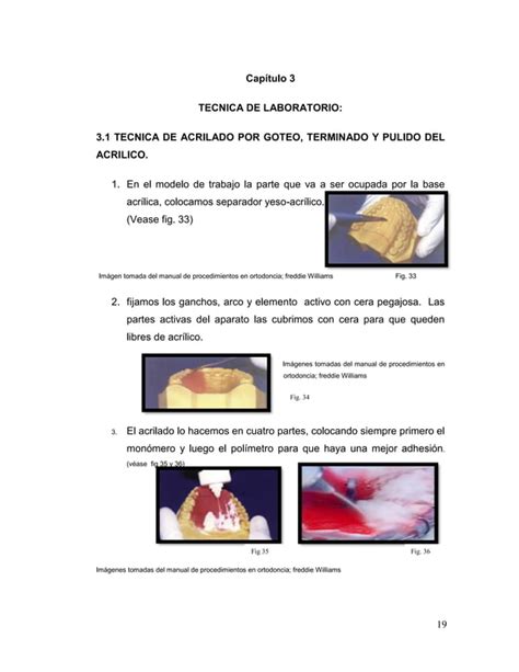 Manual De Ortodoncia Por Andrea Berrios Pdf