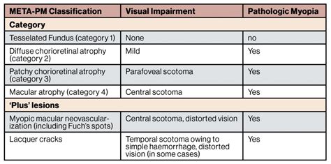 Management Of High Myopia Insight