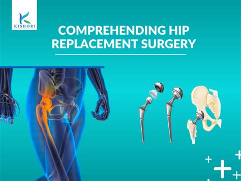 Comprehending Hip Replacement Surgery Kishori Nursing Home Hospital In Bargarh