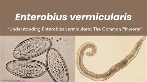 Enterobius Vermicularis Pinworm Symptoms Diagnosis Prevention And Treatment