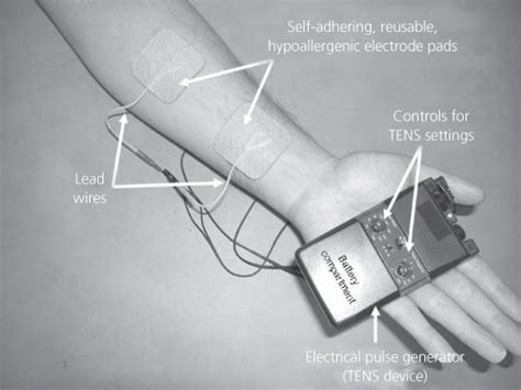 The Role Of Transcutaneous Electrical Nerve Stimulation Tens In Pain