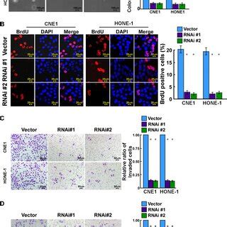 RNF219 Knockdown Inhibits NPC Cell Proliferation Migration And