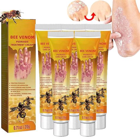 Youth Bee Venom Psoriasis Treatment Cream New Zealand Bee Venom