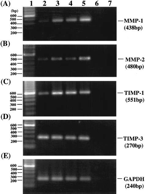 Rt Pcr Analysis For Mmp And Timp Mrnas In Cytokinestimulated Pecs